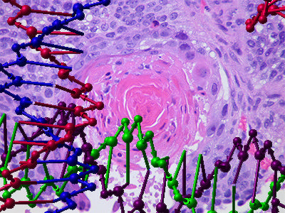 Genomics of Cancer Cells