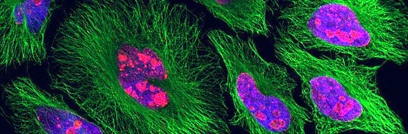 Immunohistochemistry