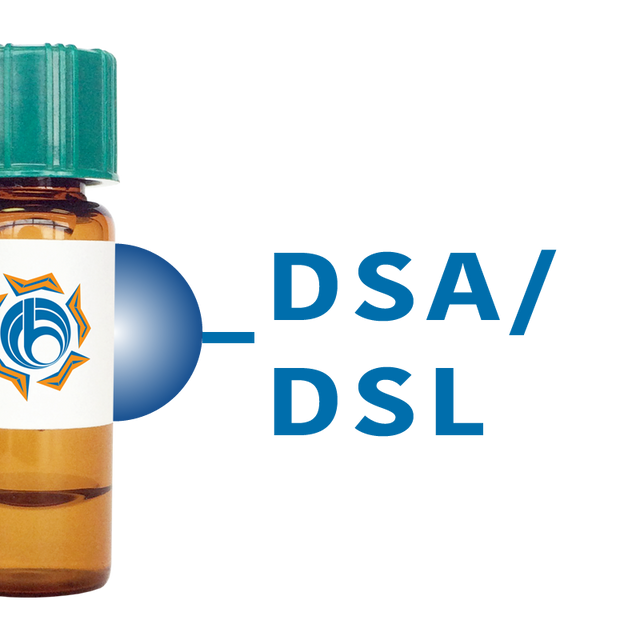Datura stramonium Lectin (DSA/DSL) - Separopore® 4B