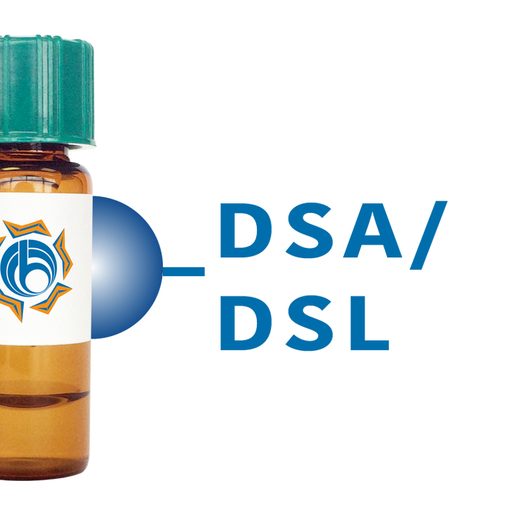Datura stramonium Lectin (DSA/DSL) - Separopore® 4B