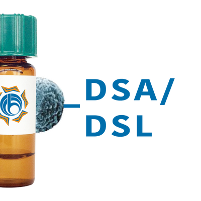 Datura stramonium Lectin (DSA/DSL) - MagneZoom™