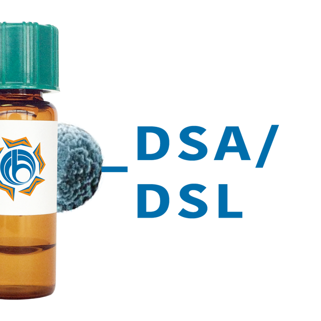 Datura stramonium Lectin (DSA/DSL) - MagneZoom™