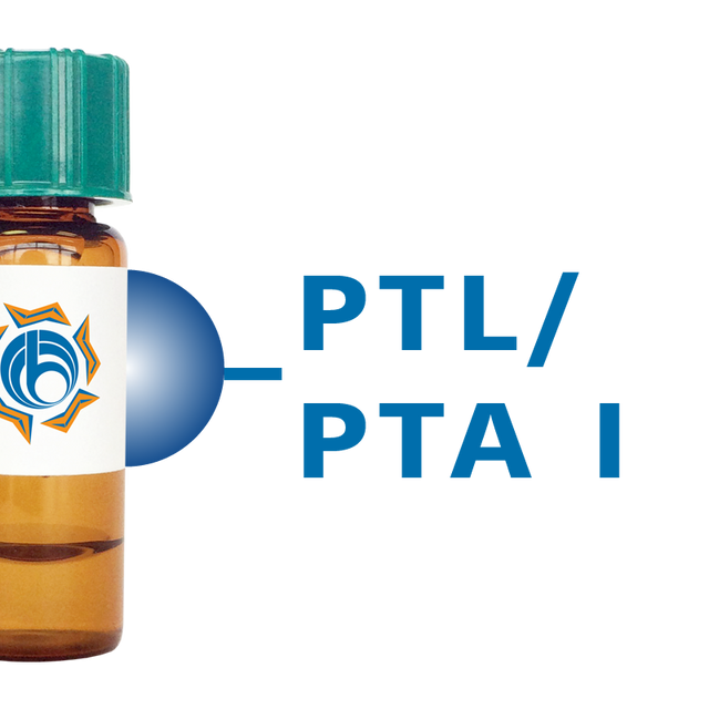 Psophocarpus tetragonolobus Lectin (PTL/PTA I) - Separopore® 4B