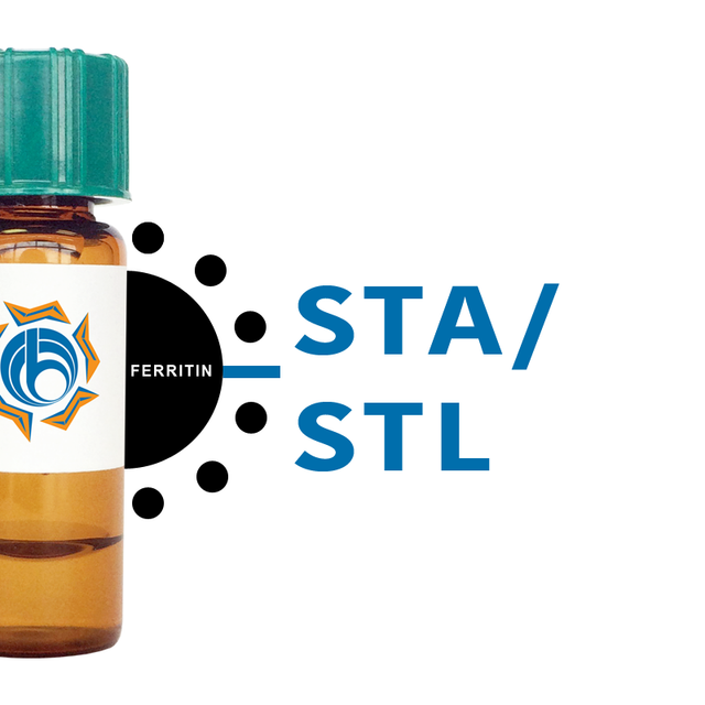 Solanum tuberosum Lectin (STA/STL) - Ferritin